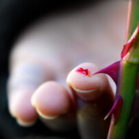 Thorns and Healing – by Melissa Kane